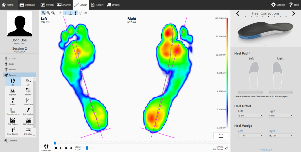 gait analysis foot scan