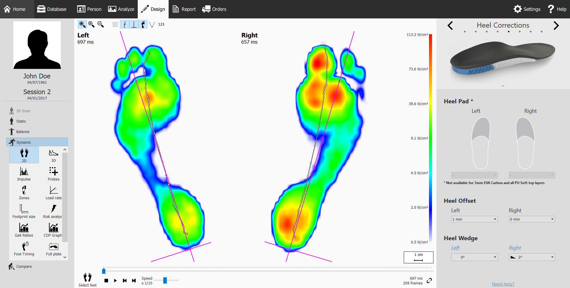 Dynamic footscan gait analysis